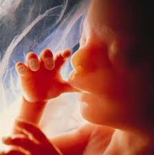Saint Thomas and the Unborn